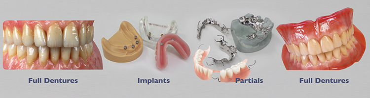 Dentures Implants Partials