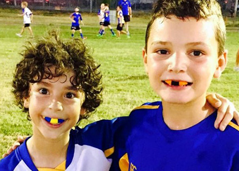 Coloured Mouthguards