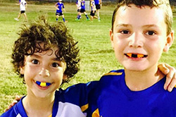 Coloured Mouthguards