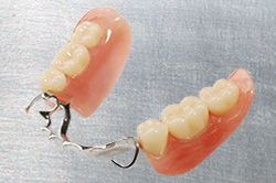 Partial Dentures - Denture Health Care