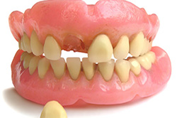Repair Dentures